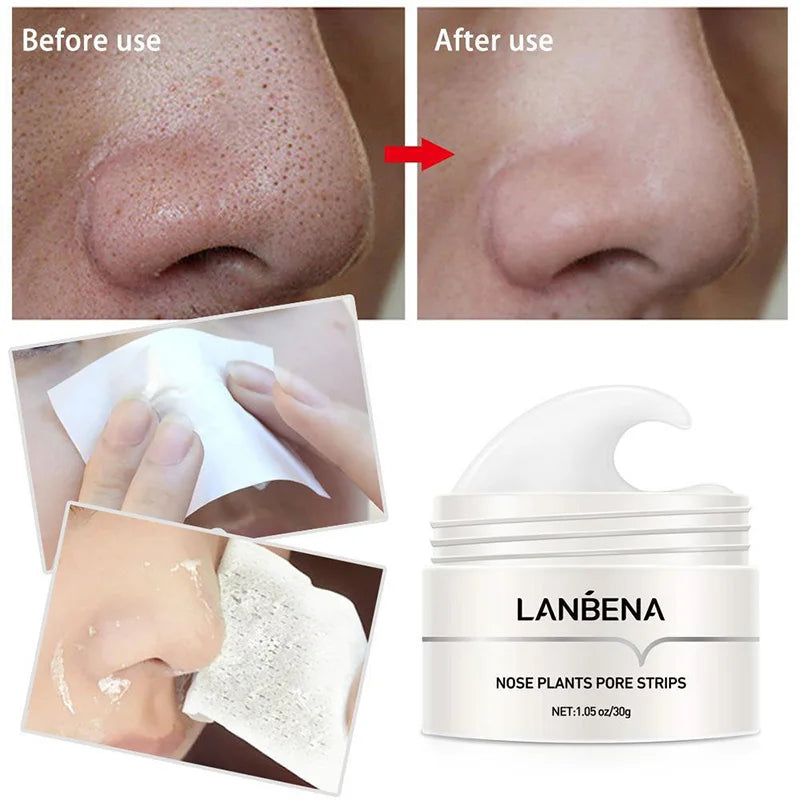 Blackhead Remover Nose Pore
